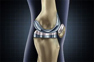 Center Knee Surgery Treatment